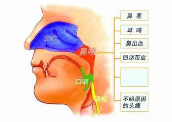 鼻咽癌疾病有哪些预防方法