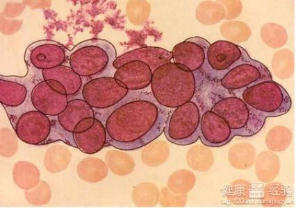 结肠癌手术后如果不想进行放化疗手术怎么办