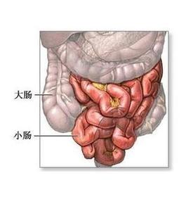小肠癌发病原因