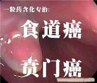 一粒药含化消癌疗法—专业治疗食道癌贲门癌