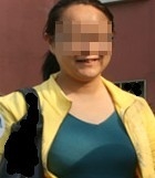 宫颈癌康复患者